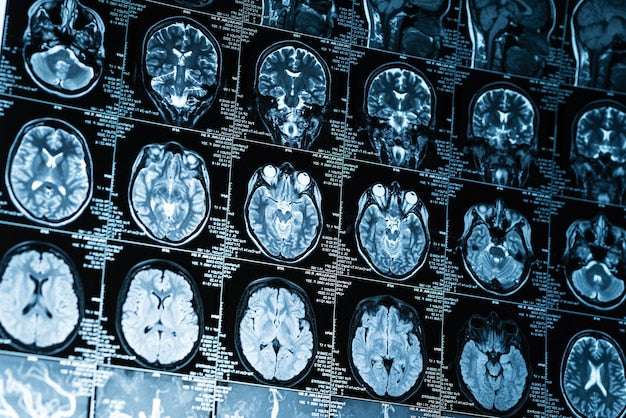 Neurociencias y Salud Mental